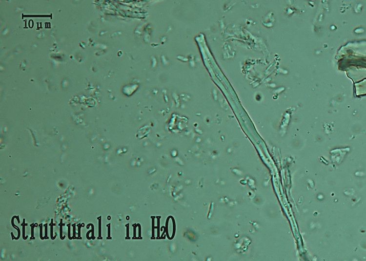 E'' sempre la solita Schizopora paradoxa?-foto8650 (Antrodia)